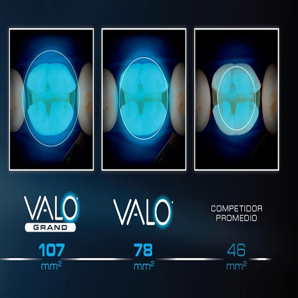 Valo Grand and Valo Cordless lamp vs. competitors