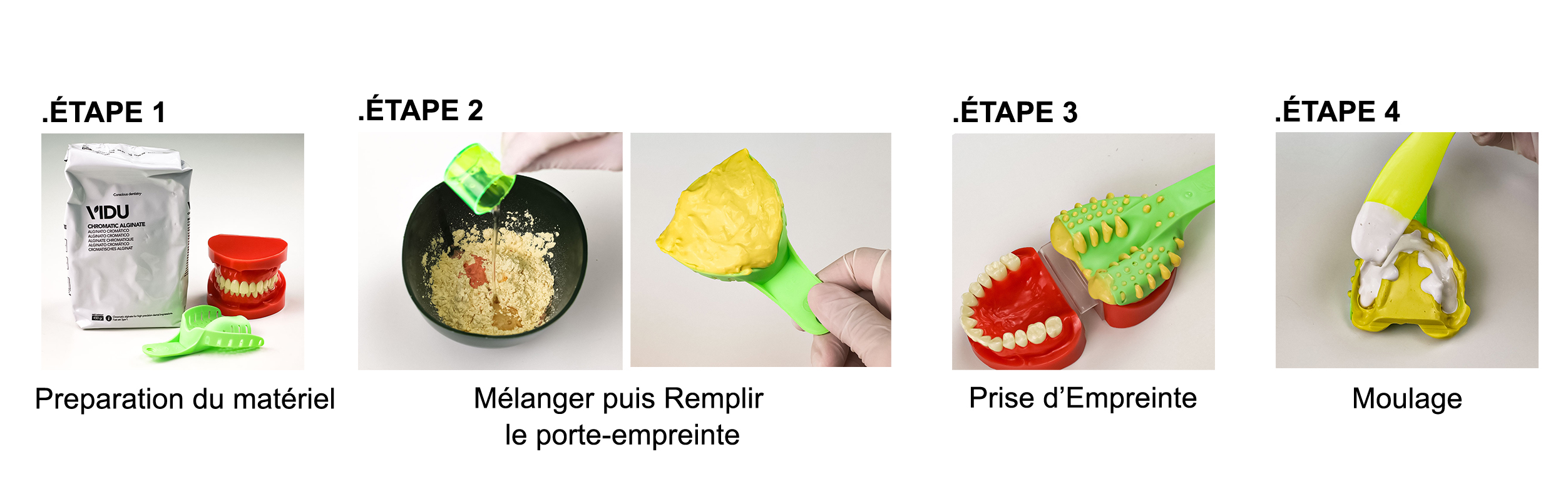 Phases de l'alginate dentaire