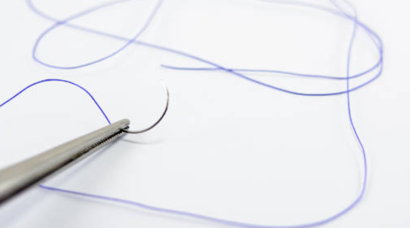 classes de suture en médecine dentaire