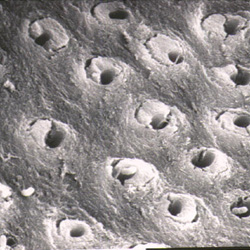 Dentine observée au microscope