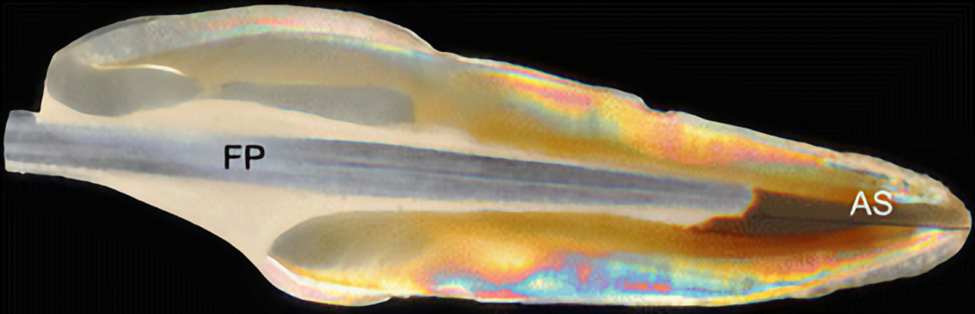 Dent traitée avec tenon en fibre de verre