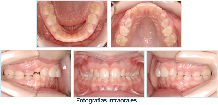 Fotographie intra-orale