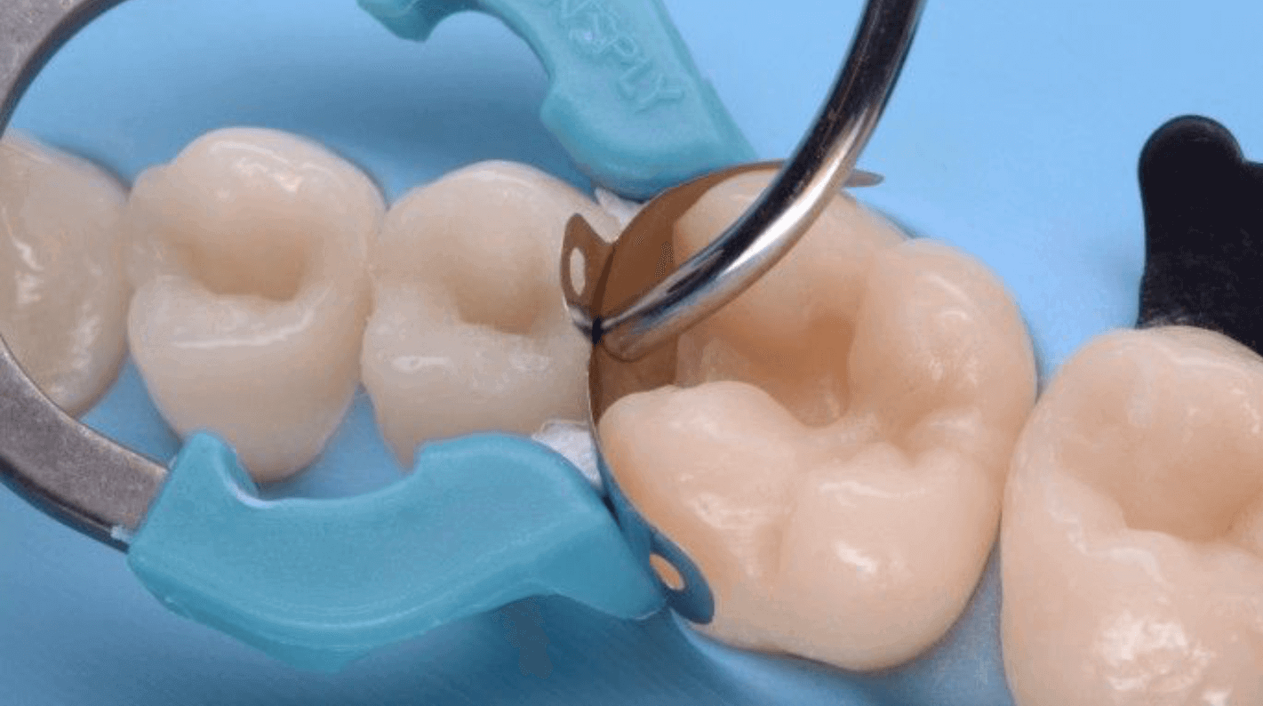 Matrices dentaires préformées