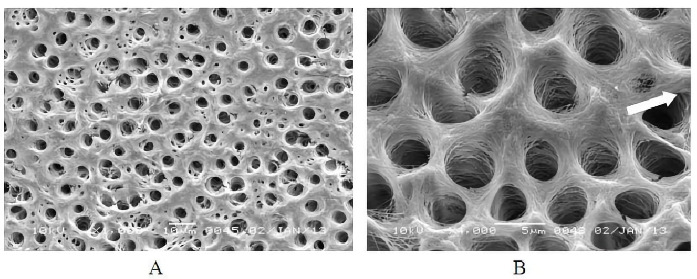 Белковые канальцы. Металлопротеиназы в дентине. Дентин электронный микроскоп. Дентин под микроскопом. Деттин под микроскопом.
