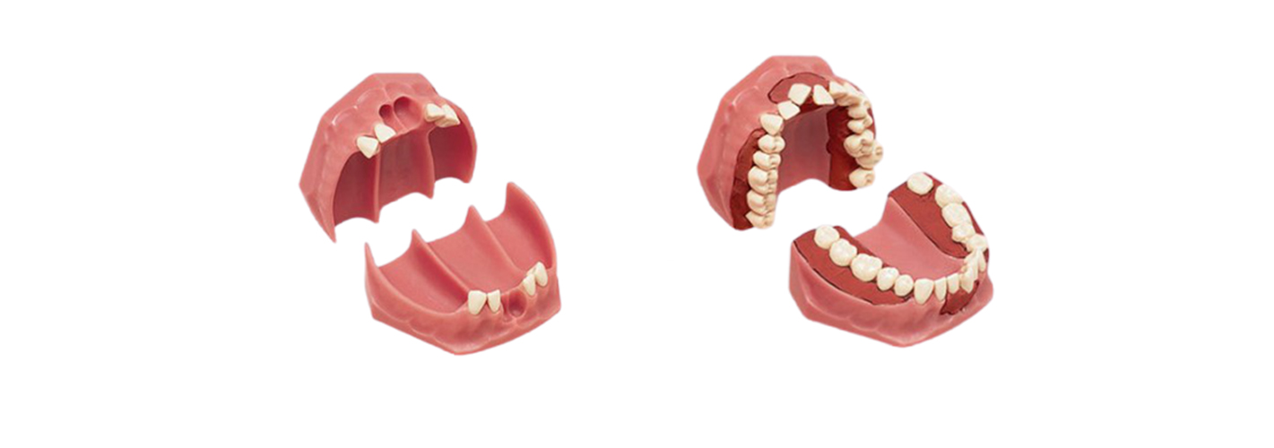 Modèles d'Orthodontie de Frasaco
