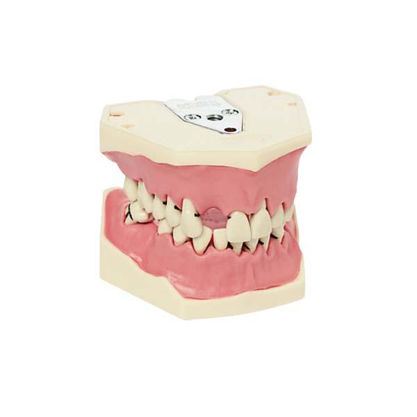 A-PB : Modèle de maxillaire et de mandibule pour la parodontie - A-PB Img: 202209101