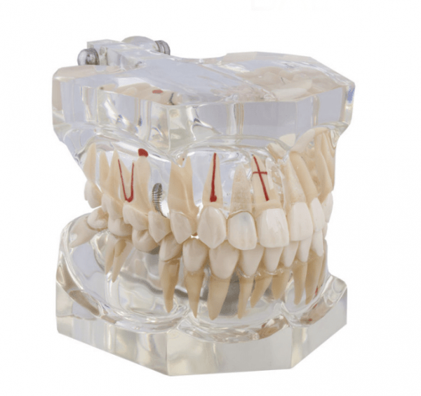 Macromodèle avec pathologie complète - Macromodèle dentaire Img: 202008291