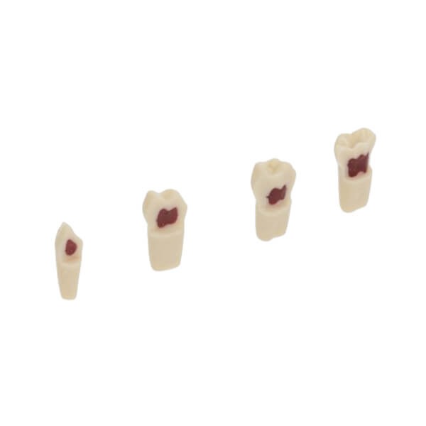 AK62Z : Modèle de dents temporaires pour préparations (10 pcs) - AK62ZPUW - Nº55 - 10 pcs Img: 202503151