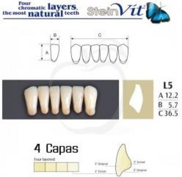 DENTS STEINVIT LO L5 C2 Img: 201807031