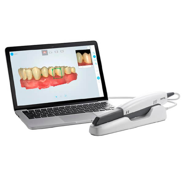BenQ BIS 1 : Scanner intra-oral avec intelligence artificielle Img: 202508091