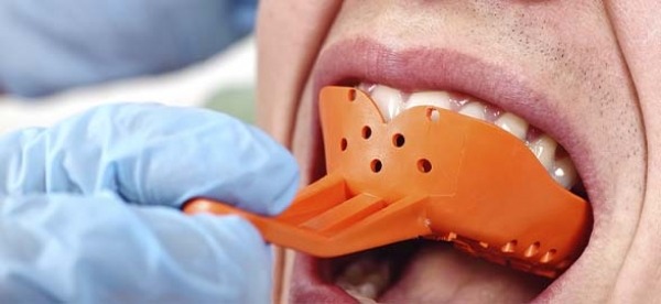 Kit Dents De Vampire + Capsules De Sang Artificiel - Avec Matériau Thermoplastique Pour Un Ajustement Personnalisé Réutilisable