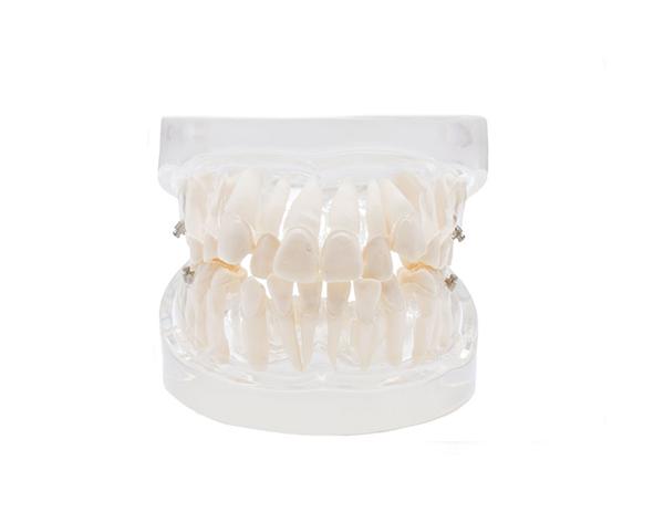 Modèle dentaire : Pratique de l'orthodontie Img: 202008291