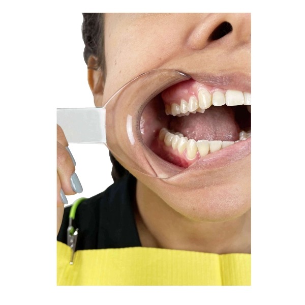 Embout Correcteur Pour Cheval – Bouche En Fer Doux – Type Trammell – Occasion