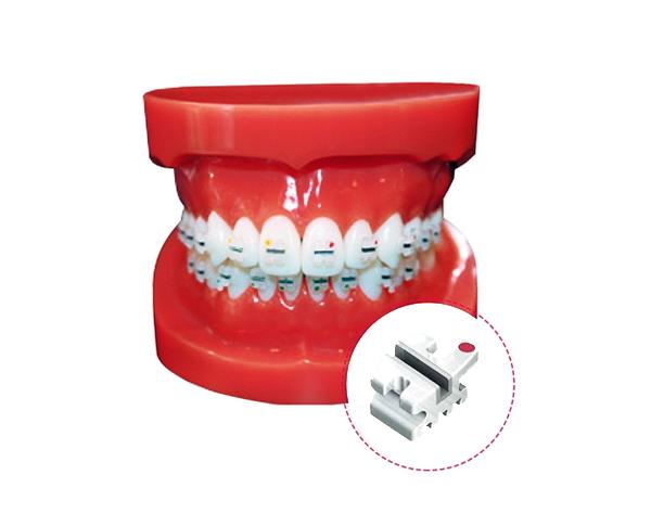 Typodont avec brackets en céramique R/M Img: 202305201