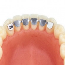 Assortiment orthodontie linguale (10 unités) Img: 201901051