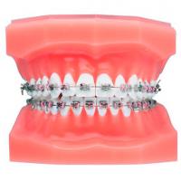 BRACKET élite Mme ROTH 022 N.31/ 32 Mini twin (Cx5u. Img: 201807031 BRACKET élite Mme ROTH 022 N.31/ 32 Mini twin (Cx5u. Img: 201807031