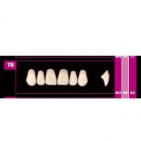 ant COSMO HXL sup T4 C2 Img: 201807031