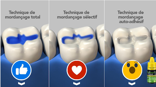 patient avec acide de mordançage