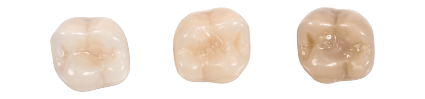 Cavités occlusales obturées avec Venus Diamond ONE dans les dents artificielles teintées B1, A2 et C4
