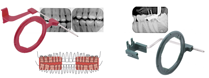 Radiographie intraorale