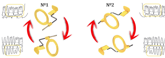 Position périapicale arcade