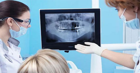 radiografia orale