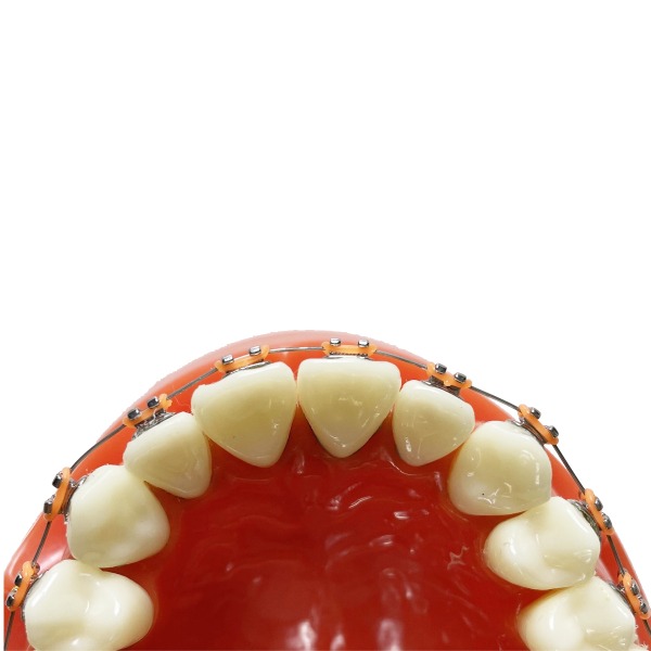 Easyinsmile Mini Staffe Autoleganti In Metallo Per ... - Alibaba - Foto 8