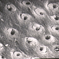 Dentina osservata al microscopio