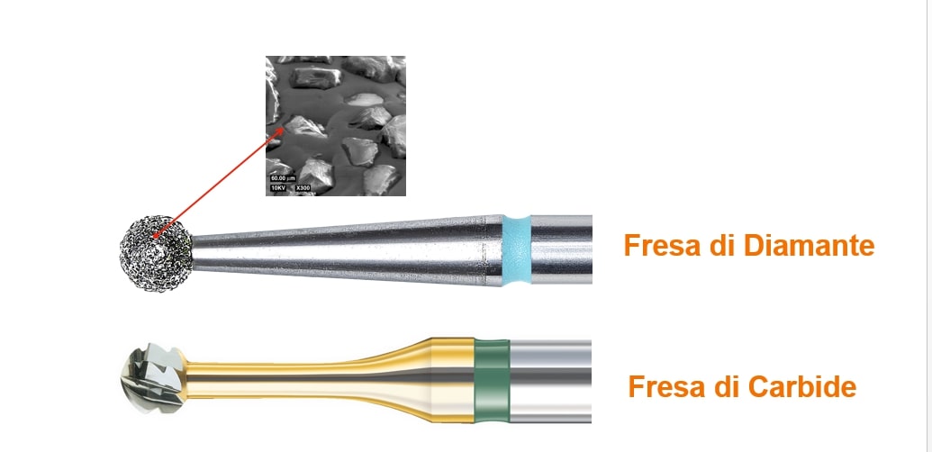 Frese dentali di Diamante e frese dentali di Carbide