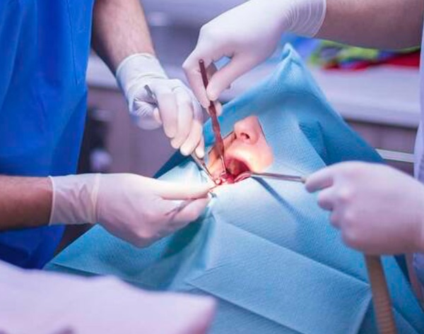 Frese da chirugia dentale e maxillofacciale
