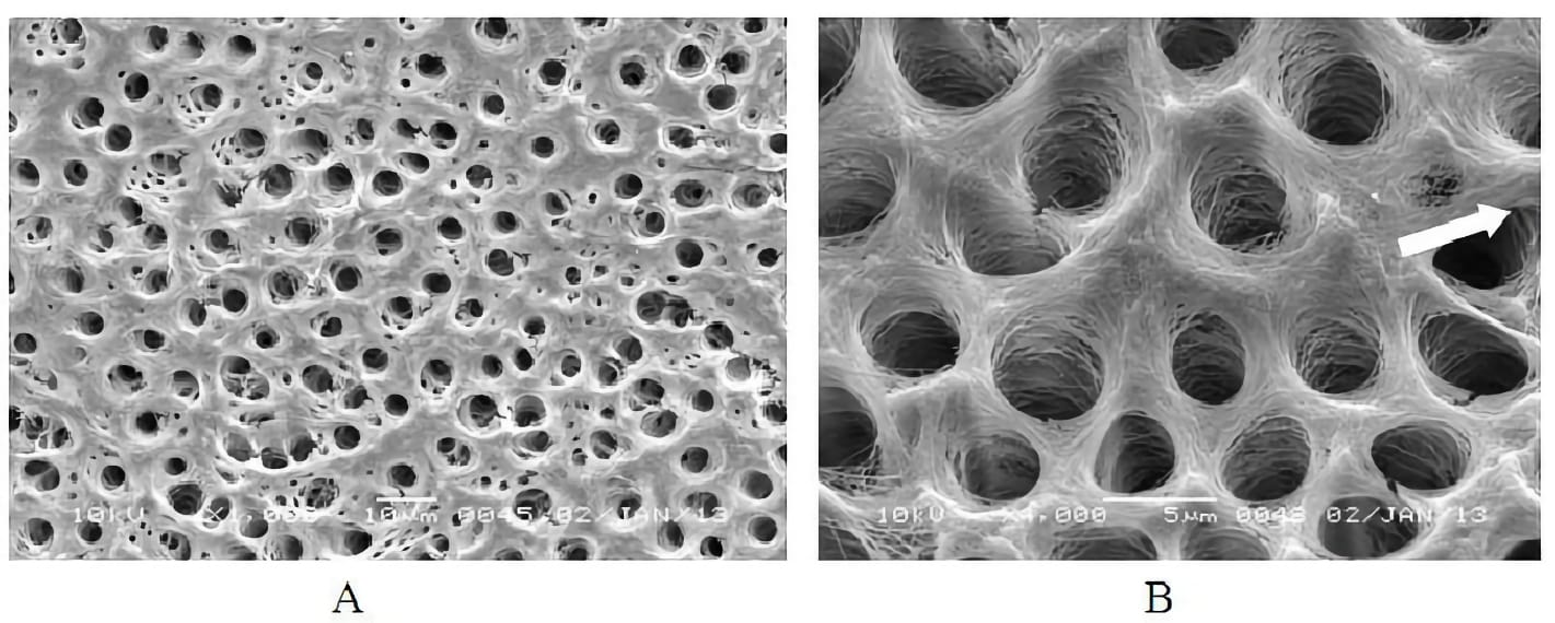 Microscopia elettronica di irrigazione con EDTA e ipoclorito di sodio