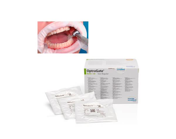 Ivoclar OptraGate 3D Lip And Cheek Retractors - Assorted 80pk - Foto 8