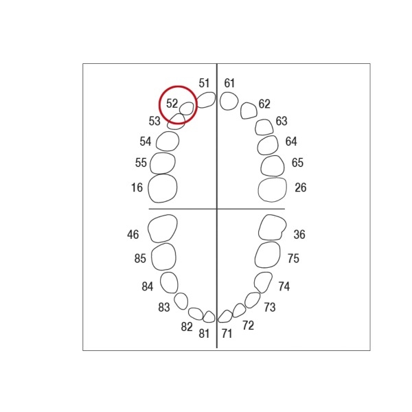 Modello di denti caduchi e molari AK-6 - AK-6 ZE nº 52 Img: 202303041