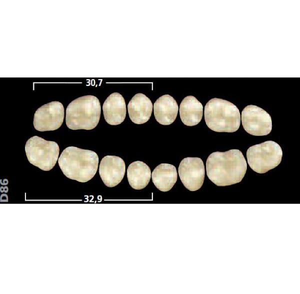 Gnathostar posto AD sup D84 A2 Img: 201807031