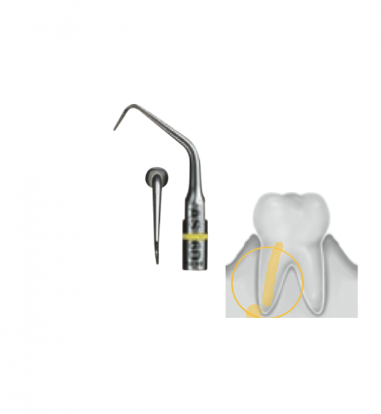 ULTRASUONI PUNTO PERIODONCIA AS6D (1U). Img: 201811031