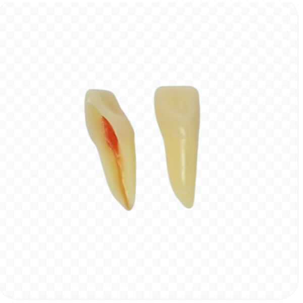 ANA4Z3: Modello di pezzi dentali per preparazioni permanenti adatto Rx (10 unità) - Nº11 -10 Ud-ANA4Z3RN11 Img: 202503151