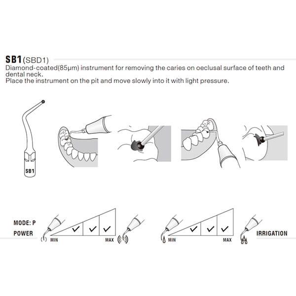 Punte Ultrasuoni SB Preparazione Cavità Per EMS - WOODPECKER - Foto 5