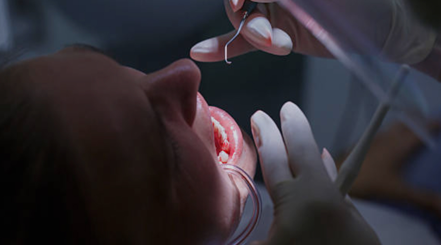 instrumentos e material para periodontia