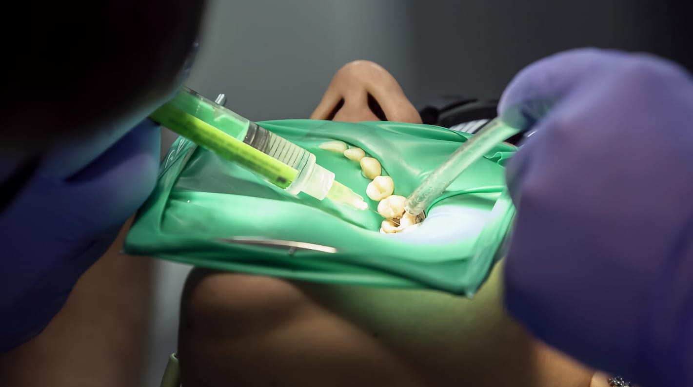 Soluções de irrigação em endodontia