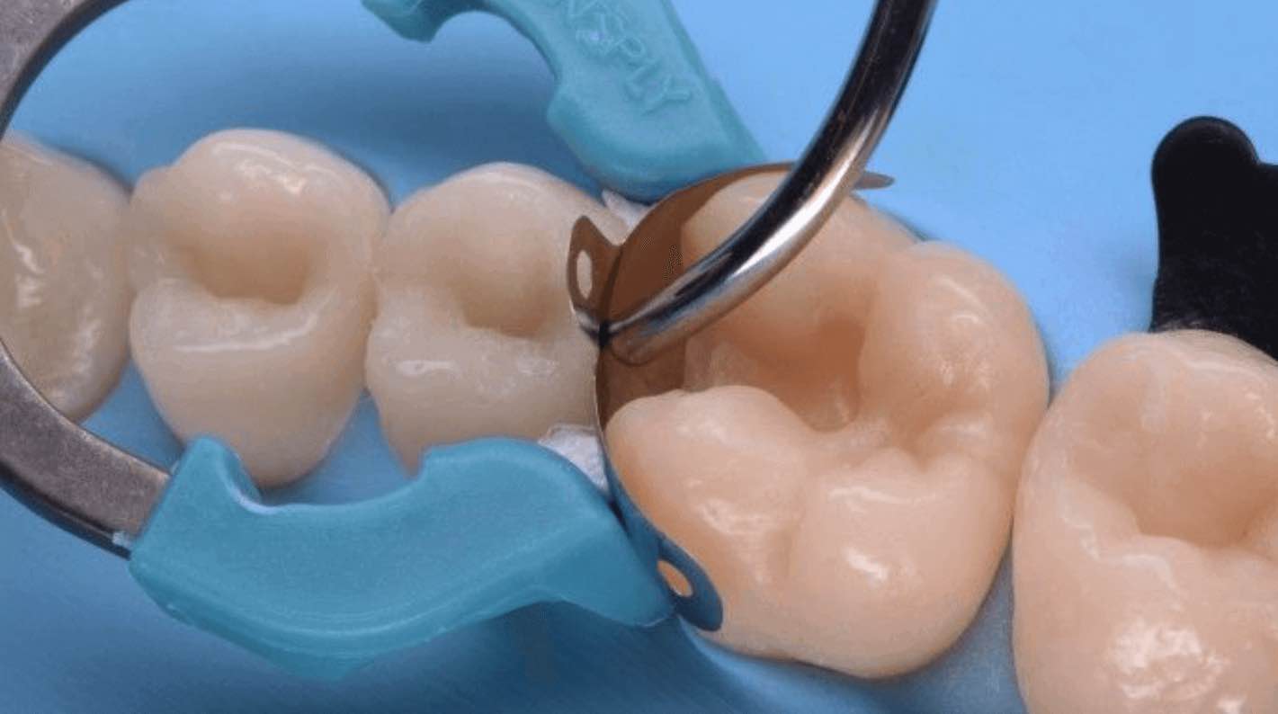 Matrizes dentais pre-formadas