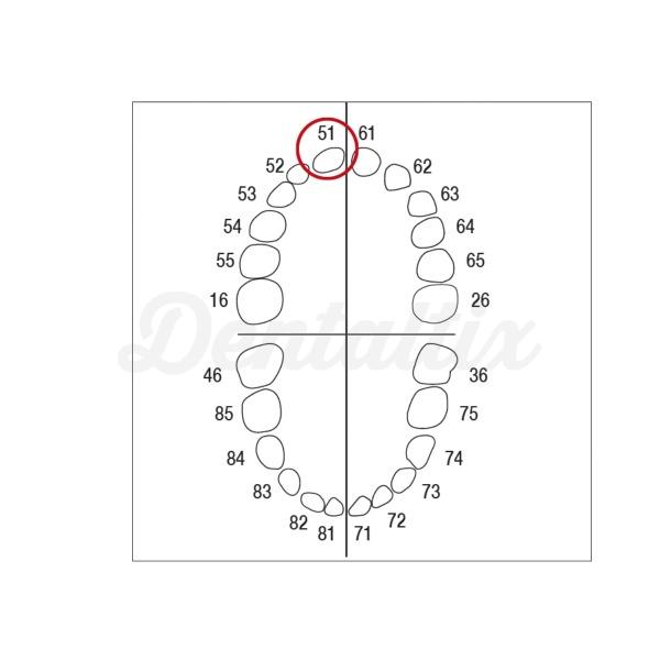Modelo de dentes decíduos e molares AK-6 - AK-6 ZE nº 51 Img: 202209101