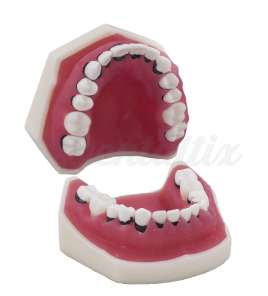 Tipodonto de Periodoncia sem Articulador -Modelo periodontal sem articulador Img: 202008221