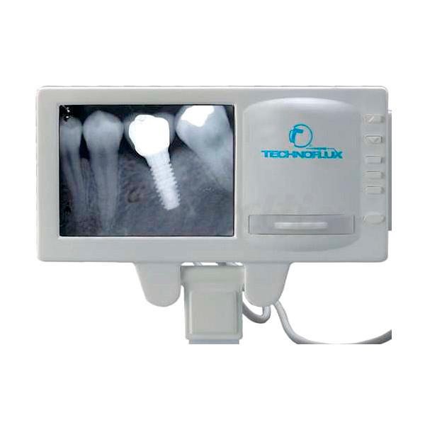 CAMARA INTRAORAL CON MONITOR Y NEGATOSCOPIO DIGITALIZABLE 168M