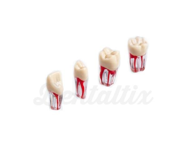 Dentes para Endodontia Transparentes do Tipodonto ANA-4 (V)