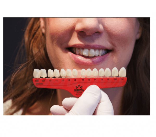 Crown Psa 2 5 Corone Dentali Temporanee In Policarbonato #100 - Foto 10