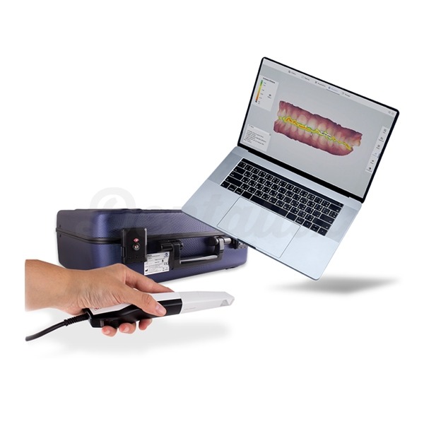 Oral Scanner: Scanner Intraoral Img: 202303041