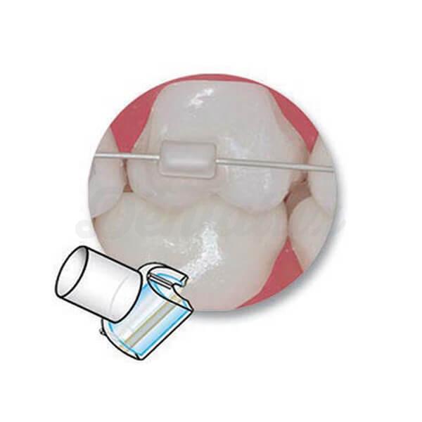 Mini Molde para Tubos Bucais  - Tubos bucais Img: 202102271