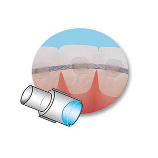 Mini-molde para Retenção Linguística 4,5 mm - Retenção linguística Img: 202102271