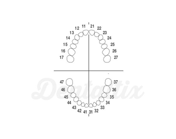 ANA-4: Dentes de substituição para Tipodonto ANA-4 V - Pacote de 10 dentes Nro 11