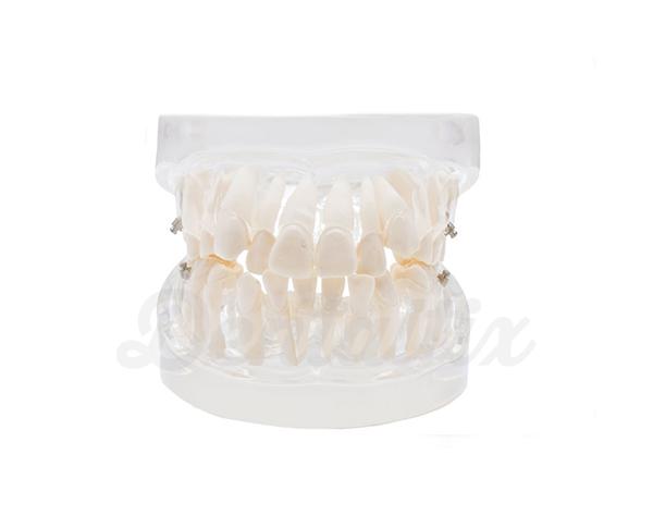 Modelo Dental: Prática Ortodôntica Img: 202008221